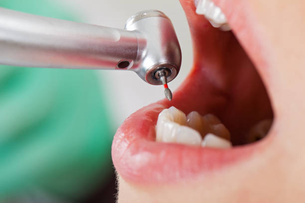 Best Chipped Tooth Repair Near Me  in Deans, NJ